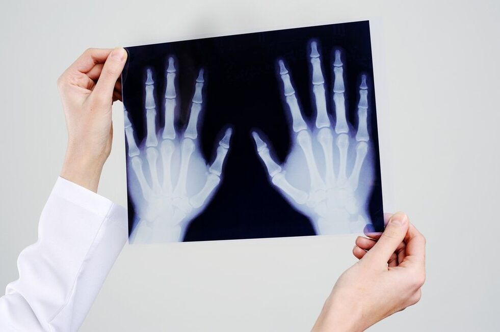 diagnostic de l'articulation de la main
